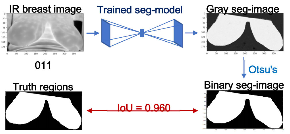 Segmentation results of one patient