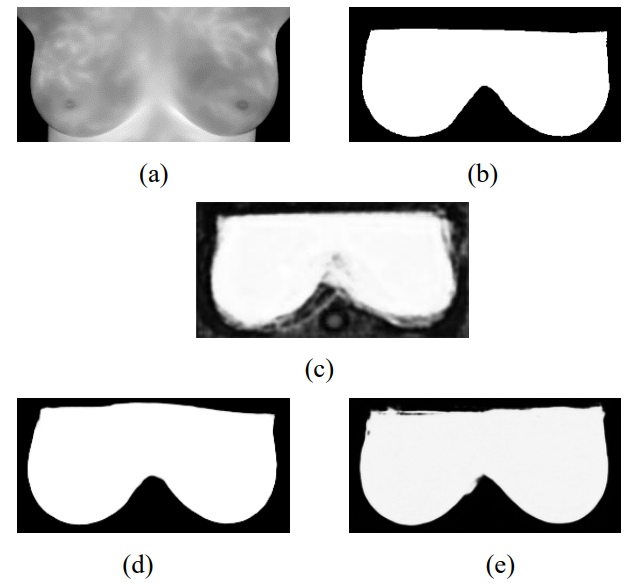 Segmentation results of Volunteer #7. (a) Cropped Image (b) Manual ground-truth (c) C-DCNN (d) U-Net (e) MultiResUnet