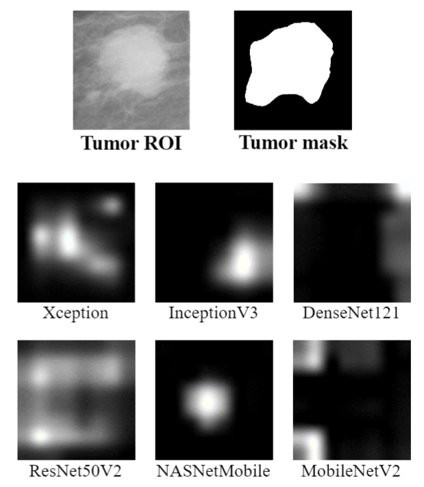The first row shows one of the abnormal (tumor) ROIs and its truth mask. Other rows show the CAMs of this ROI generated by using trained CNN classifiers and Grad-CAM algorithm.