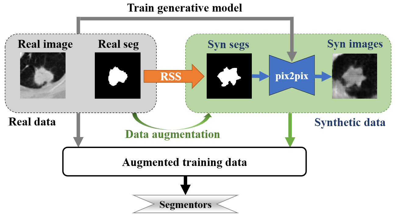 The process of how our RSS method is applied in data augmentation for segmentation tasks.