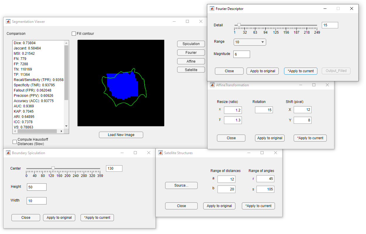  GUI of the MISS-tool for generating synthetic segmentations. The main window (upper-left) provides the
											segmentation evaluation results of 24 metric to quantify the accuracy of synthetic segmentation. The truth mask is shown
											in the blue area, and the green contour shows the synthesized segmentation.